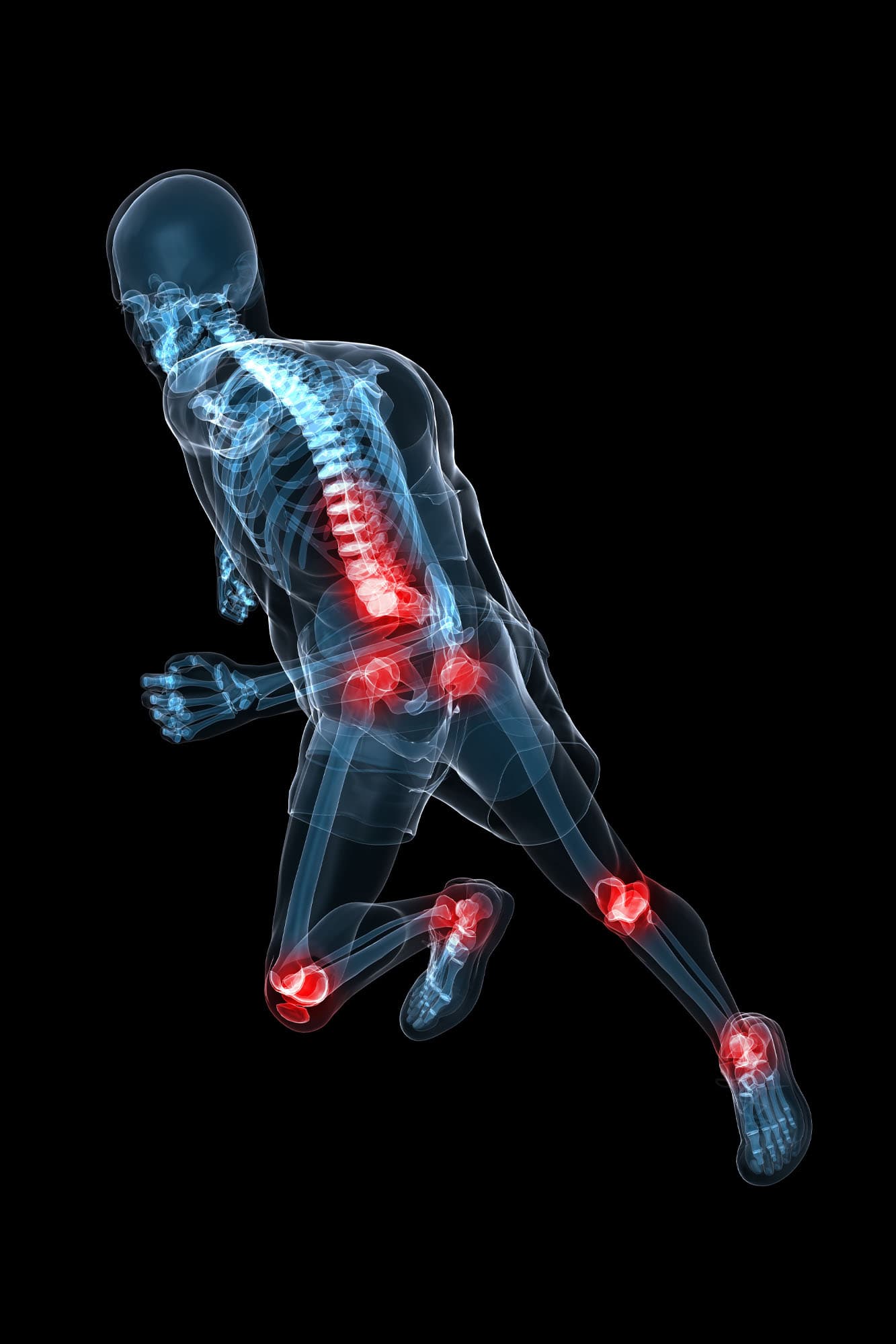 all-areas-of-running-related-injures