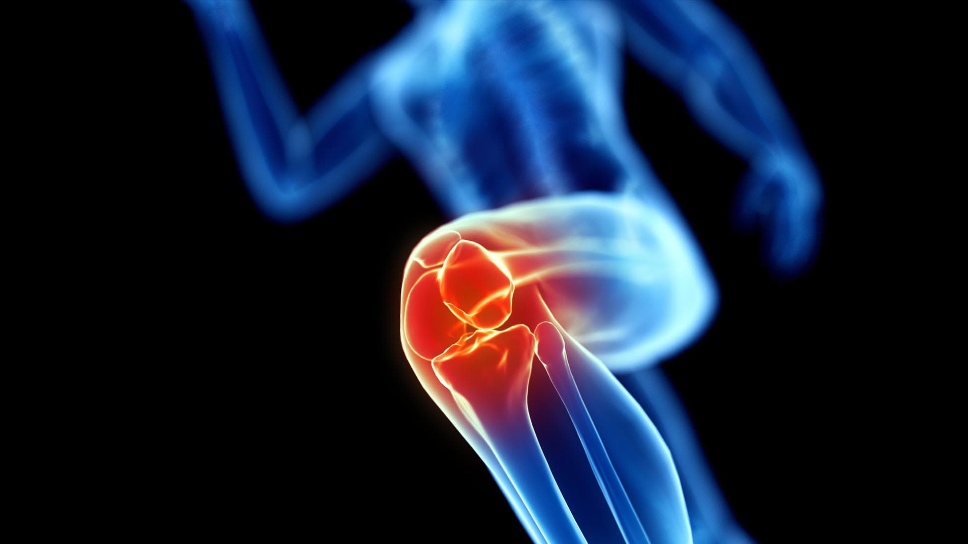 chapter-7_1_warum-wir-uns-beim-laufen-am-knie-verletzen_why-runners-most-often-injure-their-knee