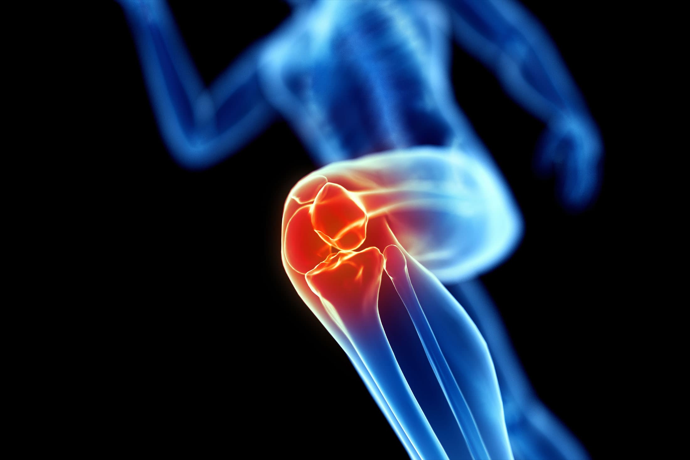 runners-knee-reasons_gruende-laeuferknie